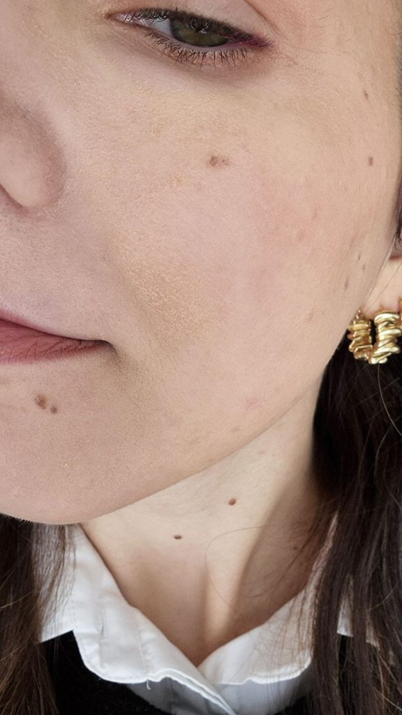 Gros plan sur la texture de la peau après l'application du fond de teint Haus Labs Triclone foundation qui marque les zones de sécheresse.
