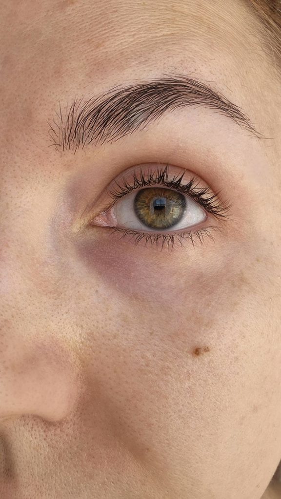 Résultat après application du contour des yeux Bio Propolia.
